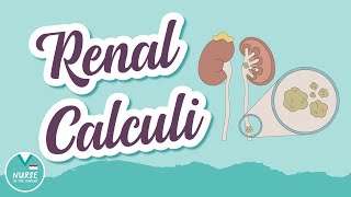 Renal Calculi AKA 