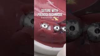 Suture with palacci technique #shorts screenshot 4