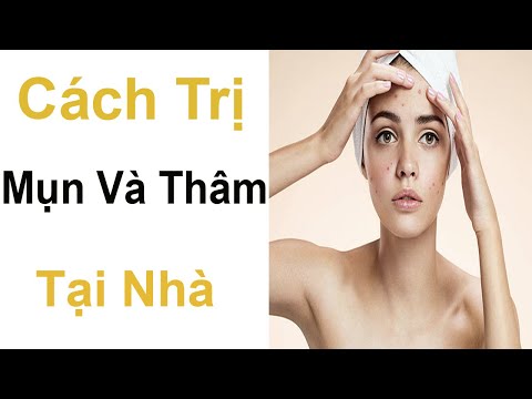 Cách Trị Mụn Và Thâm Ngay Tại Nhà - Mỹ Phẩm SOSENCO