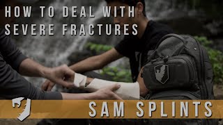 The best tool for stabilizing injuries?  SAM Splint