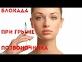 Почему нельзя делать блокады при грыже.  Why can not we do the blockade hernia