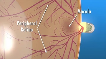 Age Related Macular Degeneration Facts