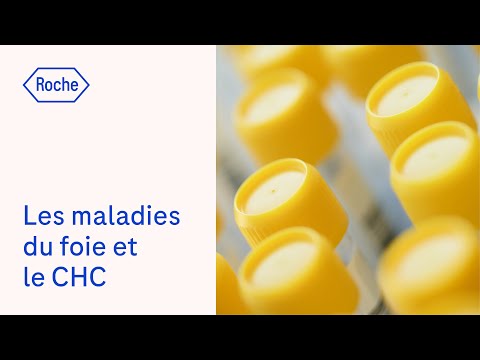 Vidéo: Comment prévenir le carcinome hépatocellulaire ?