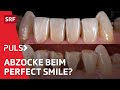 Veneers bleaching und co  der hohe preis perfekter zhne  puls  srf