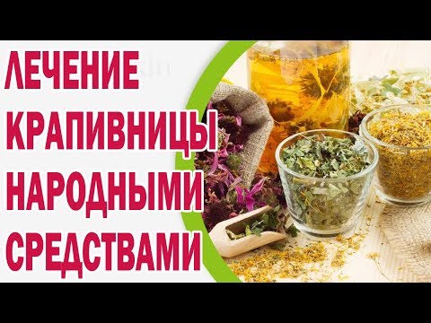 Лечение крапивницы народными средствами