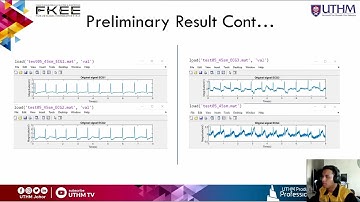 PSM 1 PRESENTATION | HARDWARE IMPLEMENTATION OF FIR FILTER FOR ELECTROCARDIOGRAM SIGNAL PROCESSING