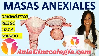 ADNEXAL MASSES: DIAGNOSIS, ULTRASOUND, RISK ASSESSMENT, MANAGEMENT... - Obstetrics and Gynecology -