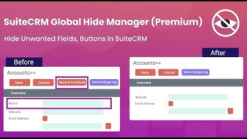 SuiteCRM Global Hide Manager (Premium)