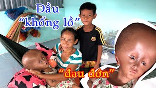 Não Úng Thuỷ em bé đầu to 