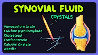 Synovial Fluid Crystals Explained | Gout, Pseudogout & Arthritis Diagnosis