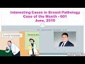 Interesting Cases in Breast Pathology (001) - Case of the Month - June 2019 by Dr. Damron