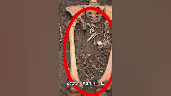 【死后分娩】孕妇去世还能自己生孩子？