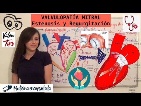 Vídeo: Diferencia Entre Estenosis Y Regurgitación