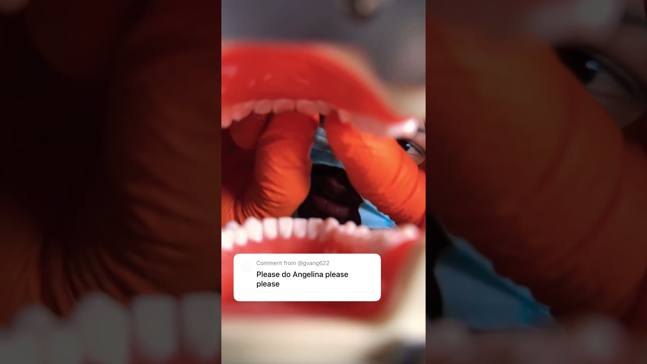Teeth Clicking Asmr Just For Angelina Doctor Hard S Personal Mouth Sounds Session Dentistasmr