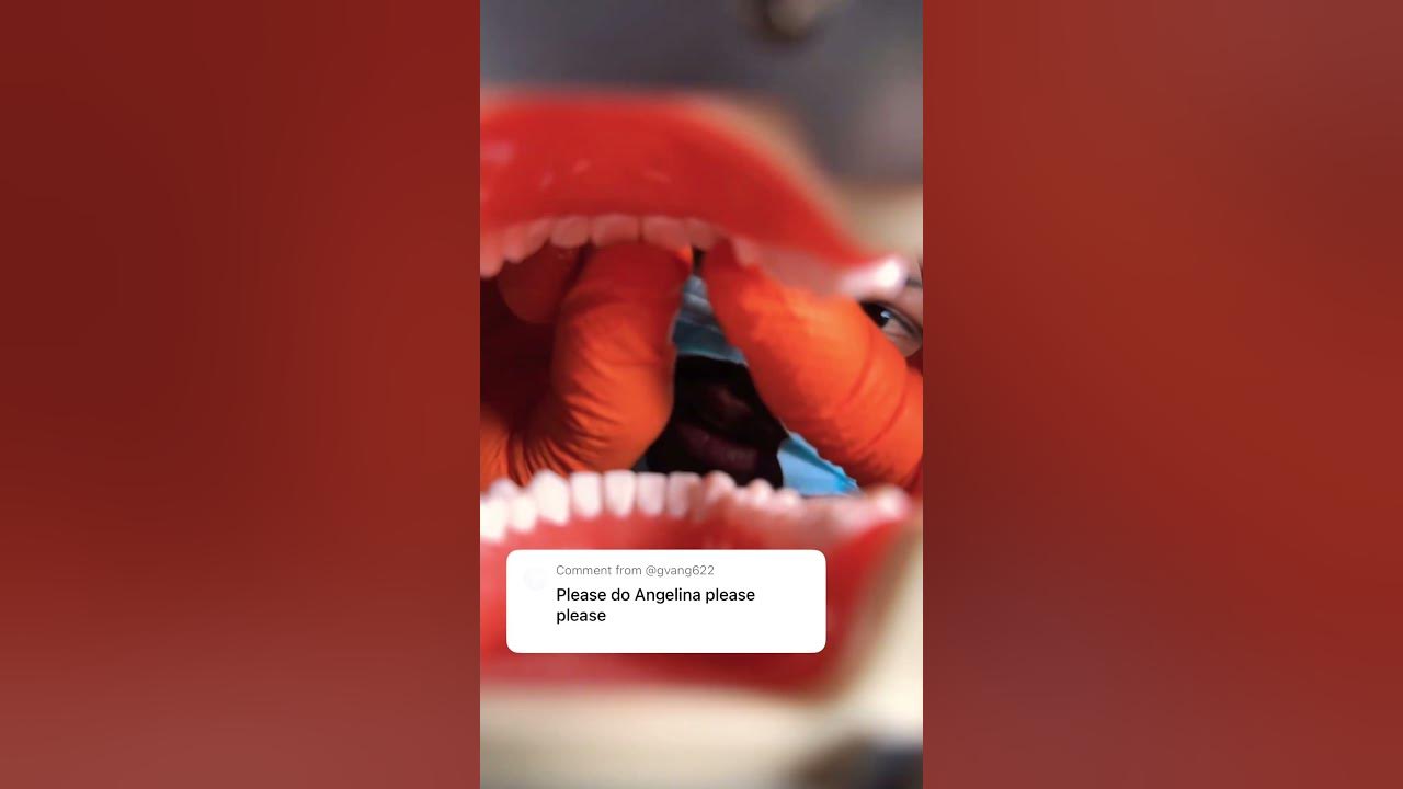 Teeth Clicking #asmr Just for Angelina - Doctor Hard’s Personal Mouth Sounds Session 🦷 #dentistasmr