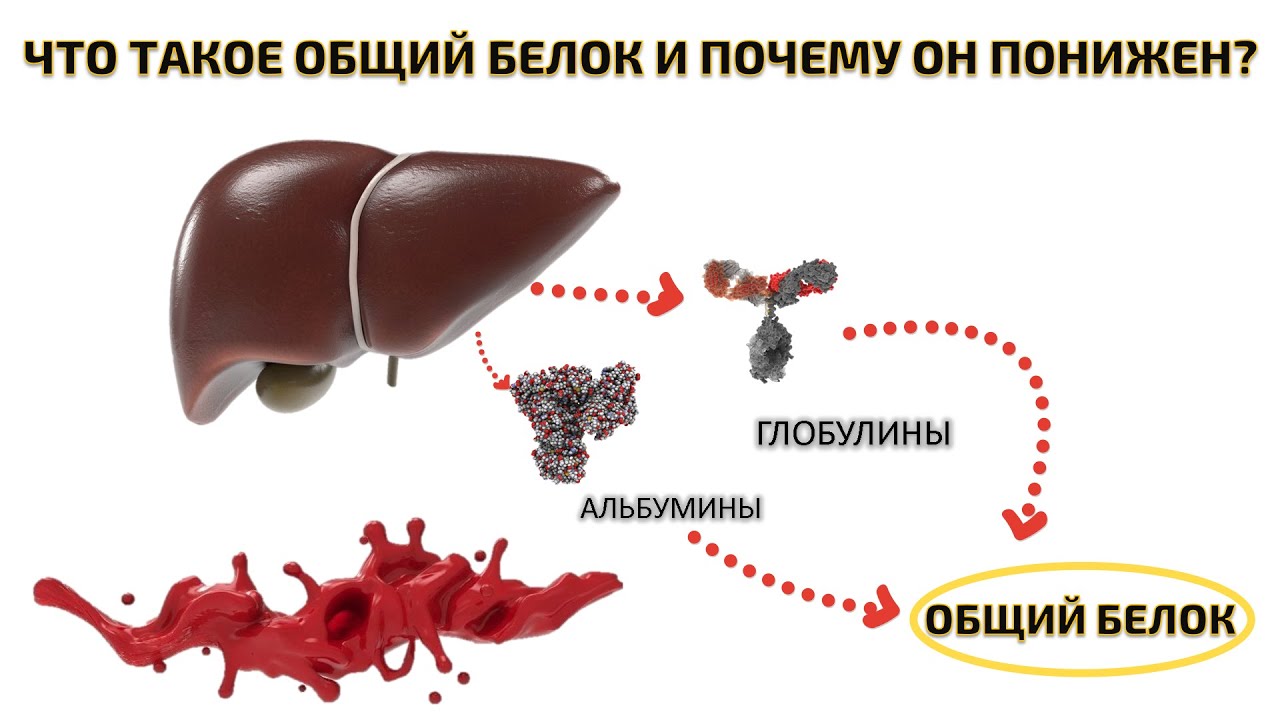 Почему понижен белок. Общий белок. Общий белок в крови понижен. Общий белок понижен причины. Снижен общий белок в крови.