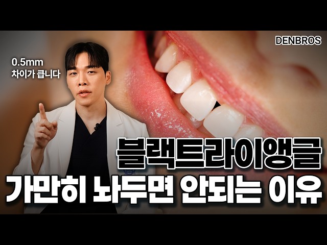 블랙 트라이앵글 생기면 얼굴 인상이 확 바뀌는 이유