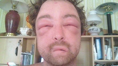 (U3V3) JusufHasani vs SYSTEM_IS_DOWN (HITT)