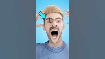 If You’re Ever Stabbed in the Eye — NEVER Do This!😱