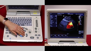 Mindray Z6: Basic overview of Doppler modes, M mode and ECG on the Z6 - video 5
