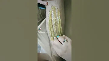 إزالة الشعر بالحلاوى 