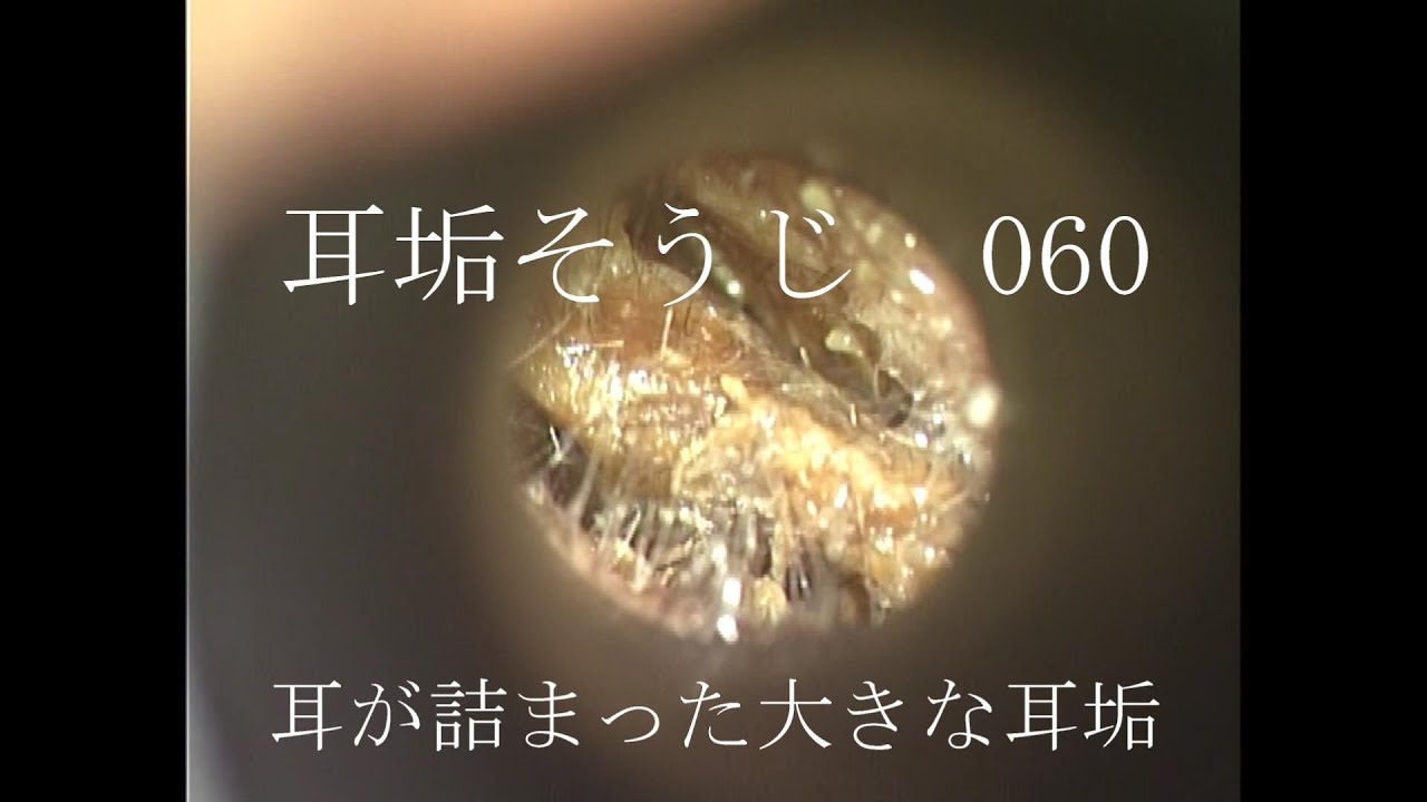 耳垢そうじ/耳が痒い/060 - YouTube