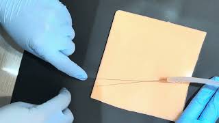 Finger trap suture urinary catheter example Wealth