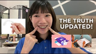 The 'Truth' About Cheap Invisible Braces UPDATED
