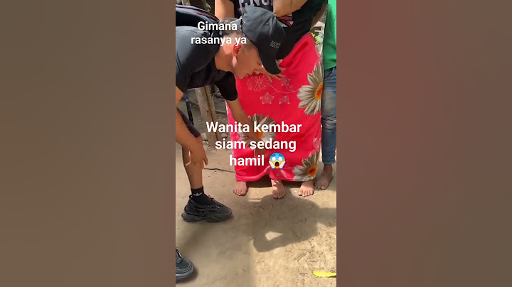 Wanita Kembar Siam Hamil