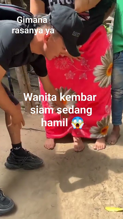 Wanita Kembar Siam Hamil