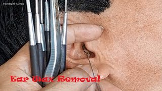 Enjoying a Vietnamese Ear Cleaning