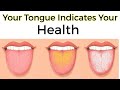 What your Tongue Says About Your Health?