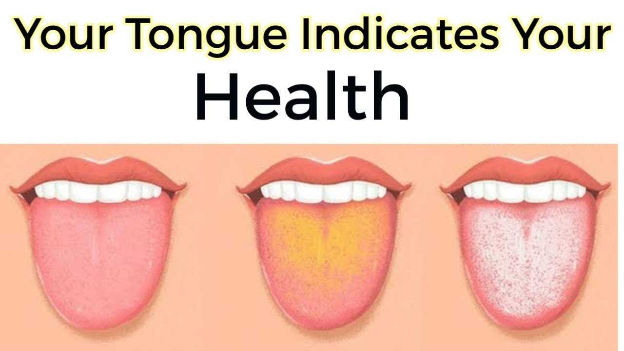 normal tongue coating