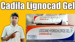 Cadila Lignocad Gel Review In Hindi | Cadila Lignocad Gel For Local Anesthesia | Cadila Lignocad Gel