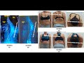   scoliosis exercises  bspts  rigo concept  schroth scoliosis  spine clinic