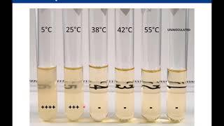 Lab 2-9: Effect of Temperature on Microbial Growth