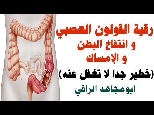 أقوى رقية للقولون العصبي و إنتفاخ البطن و الإمساك (خطير جدا) اذا كنت تعاني  منها لا تغفل عنها و كررها - YouTube