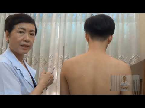 Video Thực hành hào châm điều trị Đau vai gáy cấp _Ths. Bs. - YouTube