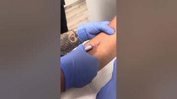 First time starting an IV 