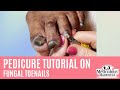 👣How to Pedicure on Thick Dark Toenails with Nail Fungus👣