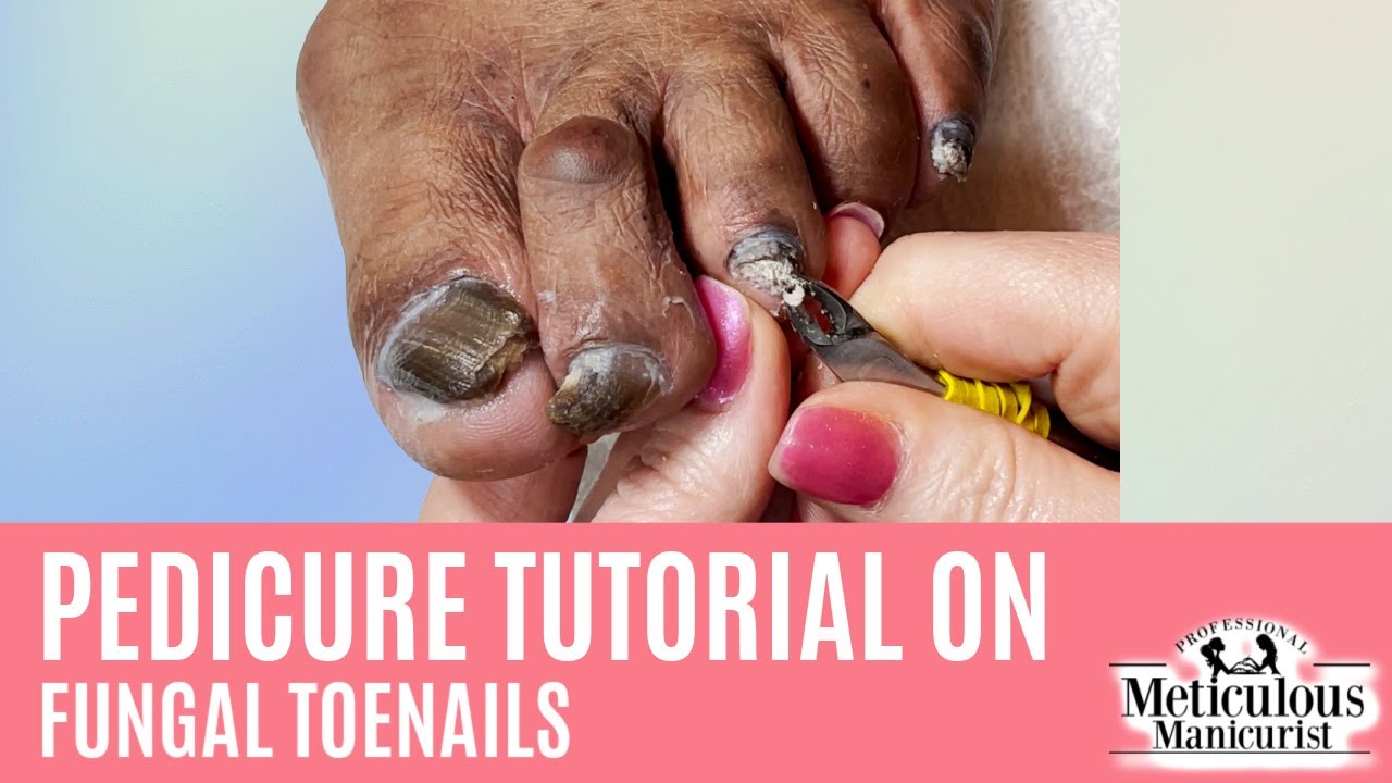 👣How to Pedicure on Thick Dark Toenails with Nail Fungus👣 