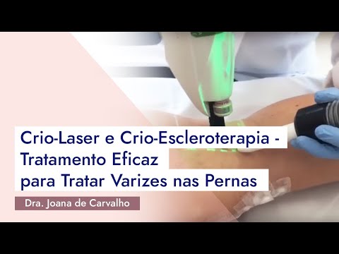 Pele pernas úlceras tratamento de fotos sensibilizada nas após
