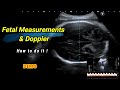 Fetal measurements and Doppler | How to do it !