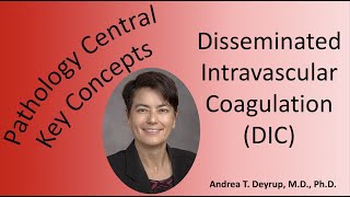 Medical School Pathology: Pathophysiology of Disseminated Intravascular Coagulation (DIC)