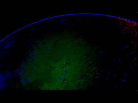 Progressive Cirkles Moonmatrix 2018