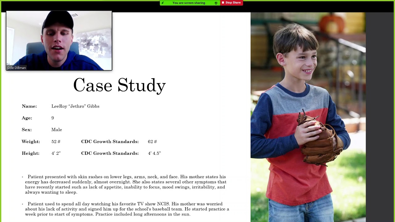 Hartnup Disease Presentation - YouTube
