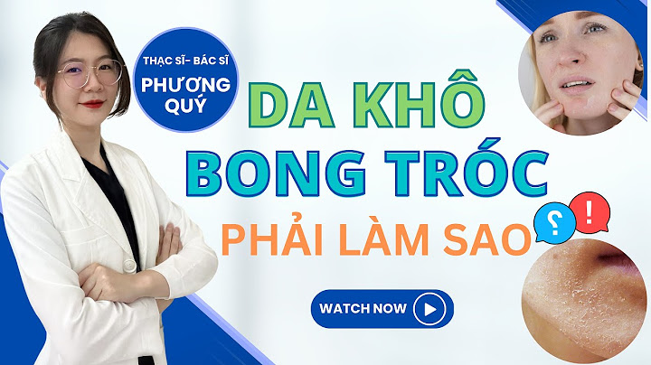 Da mặt bị khô bong tróc là bệnh gì