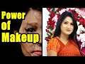 Real Bride - The Power of Makeup | Dream Fulfillment of Acid-burned Women