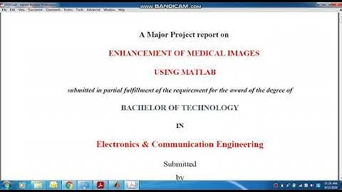 ENHANCEMENT OF MEDICAL IMAGES USING MATLAB