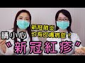 「最完整整理」 #新冠肺炎 也有皮膚病症？請小心〝新冠紅疹〞